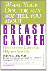 spr/prod_book_breastcanceer_03_50.gif